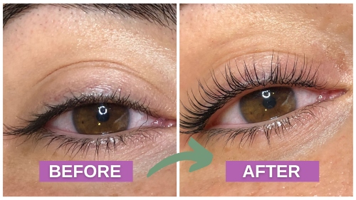 prima e dopo lash filler